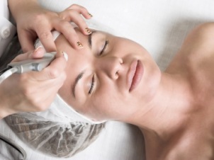 Microdermabrasion