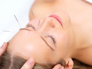 Acupuncture